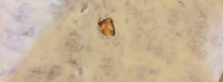 лобиани — лепешка с фасолью. Шаг 10