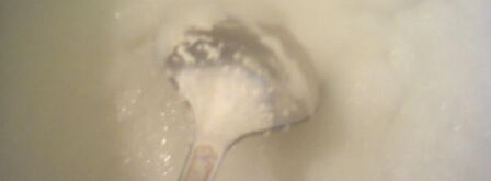 яичные биточки. Шаг 2